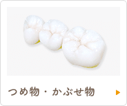 つめ物・かぶせ物
